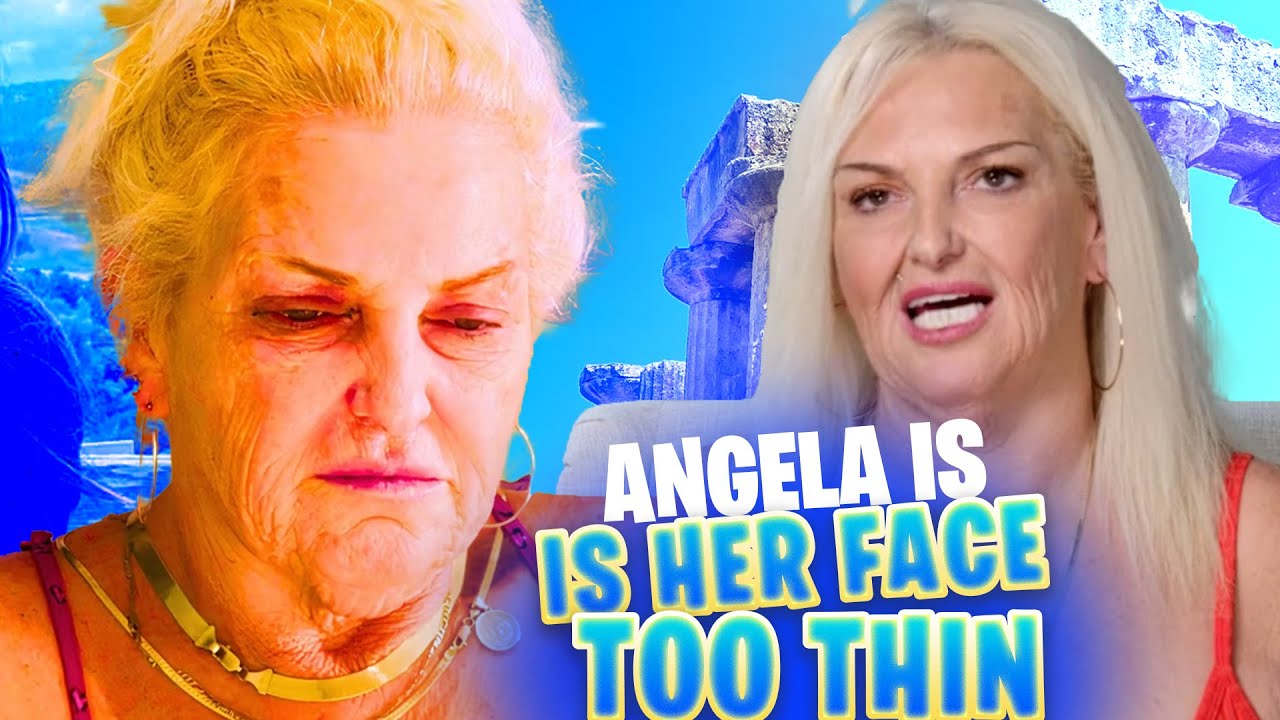 Angela Deem's Shocking Transformation Is Her Face Too Thin After(04)